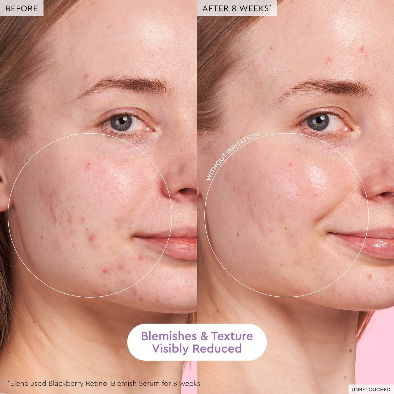 Glow Recipe  Glass Skin Hydration Kit